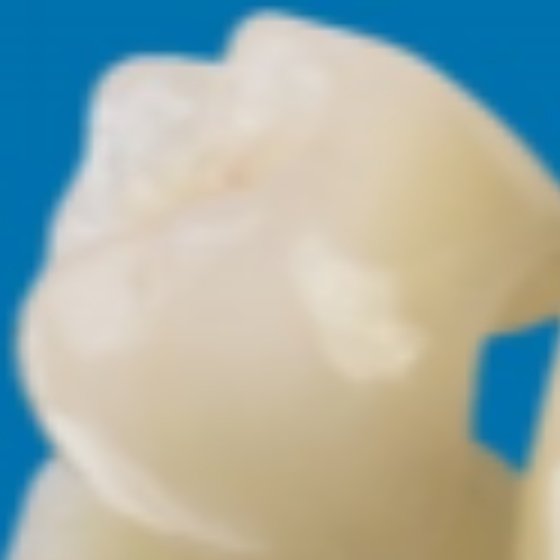 Todos-dentes de cerâmica