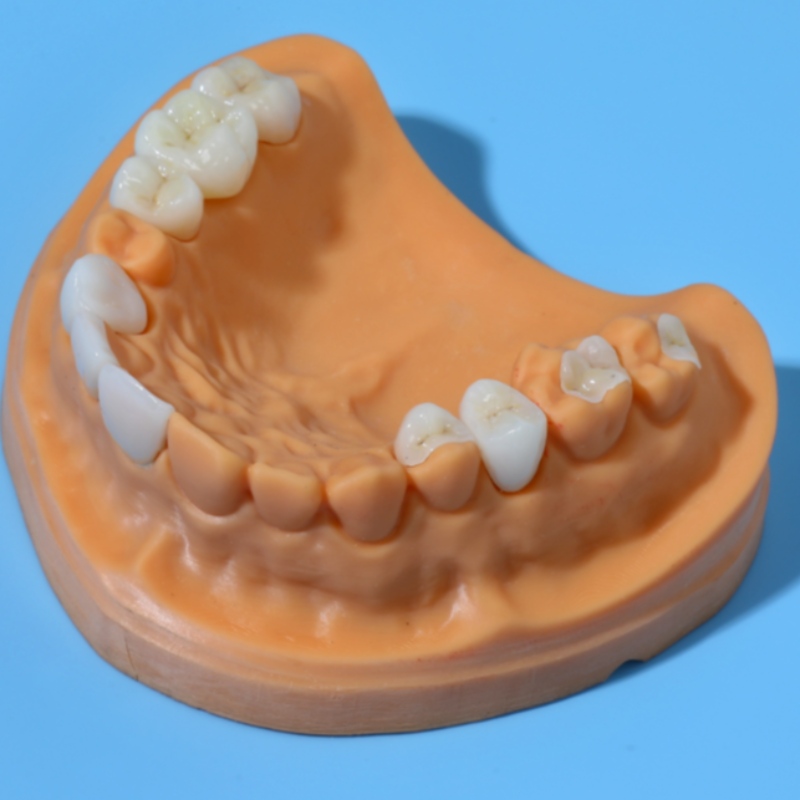 Todos-dentes de cerâmica